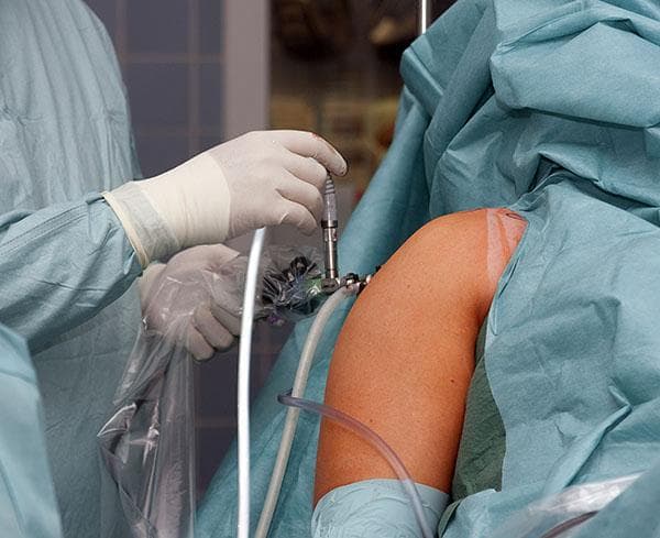 Shoulder Surgery